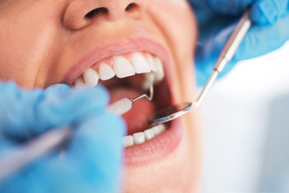 Dentist cleaning teeth